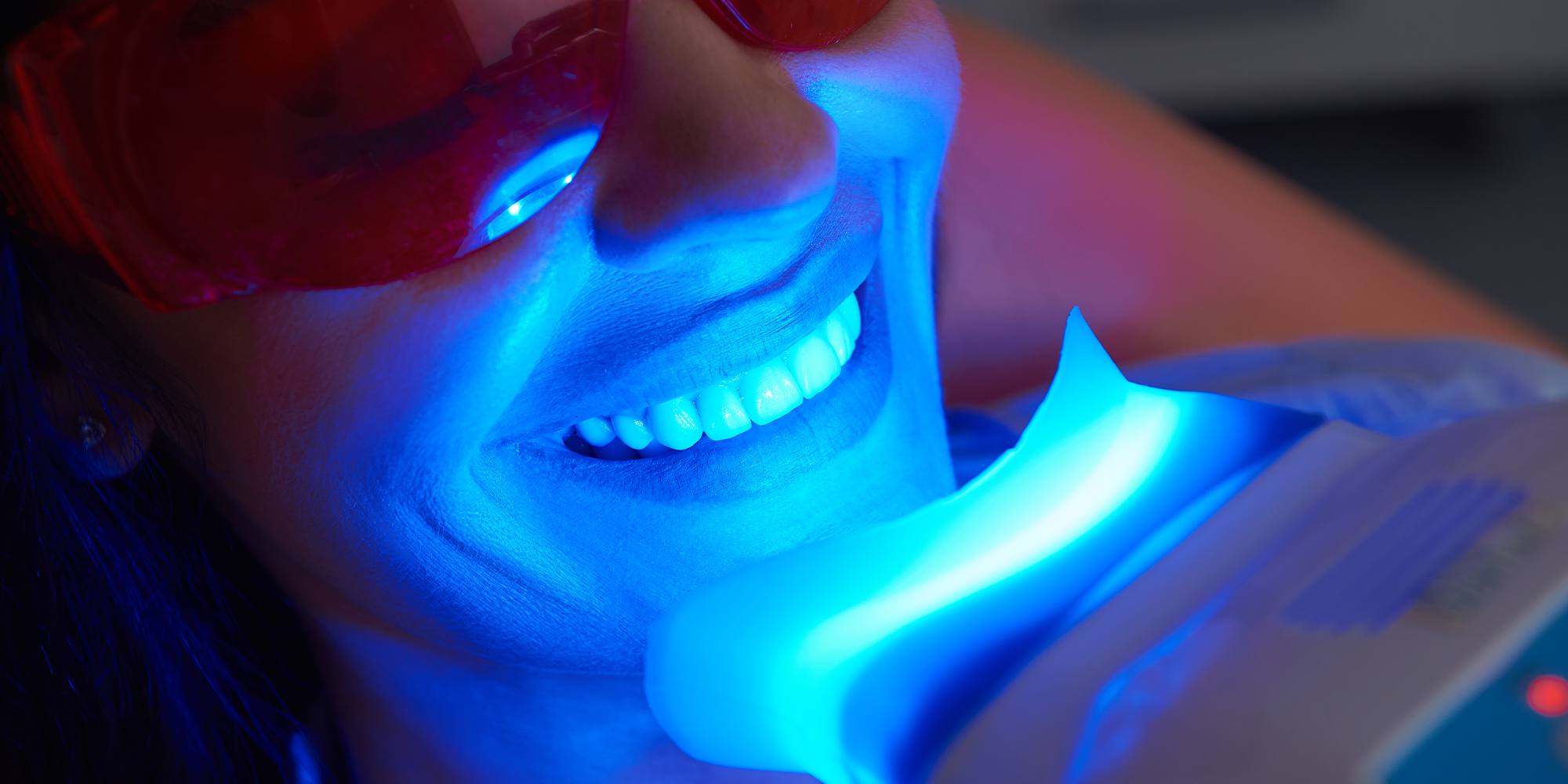 patient gettin gin office teeth whitening
