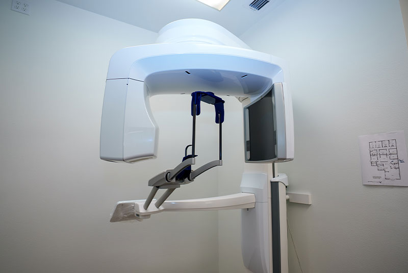cbct2