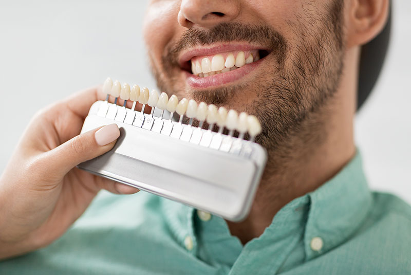 Personalized Smile Evaluation